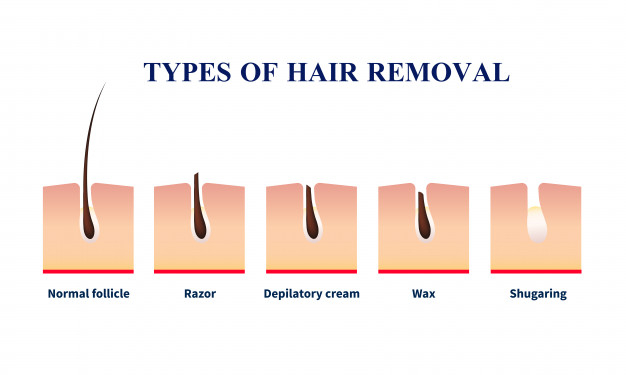 Free Types of hair removal illustration Free Vector nohat.cc