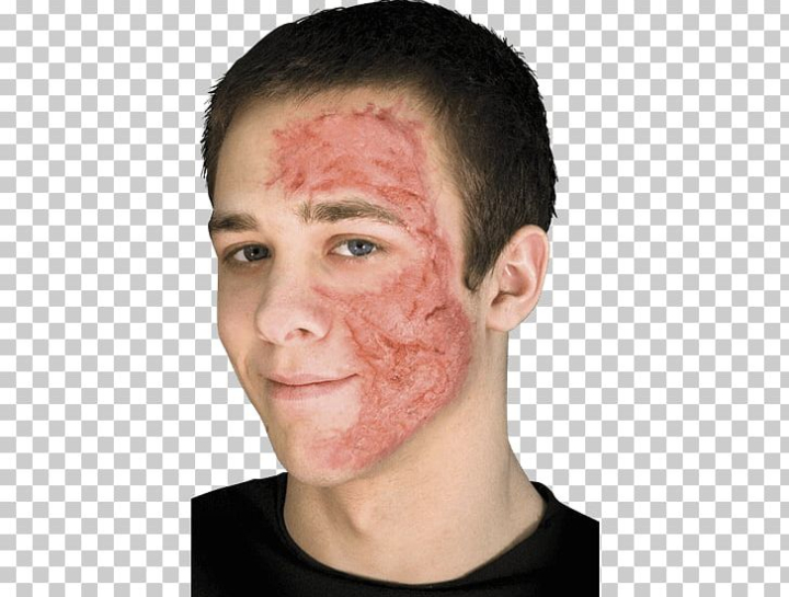 burn,scarred,scar,clipart,face,contracture,free download,png,comdlpng