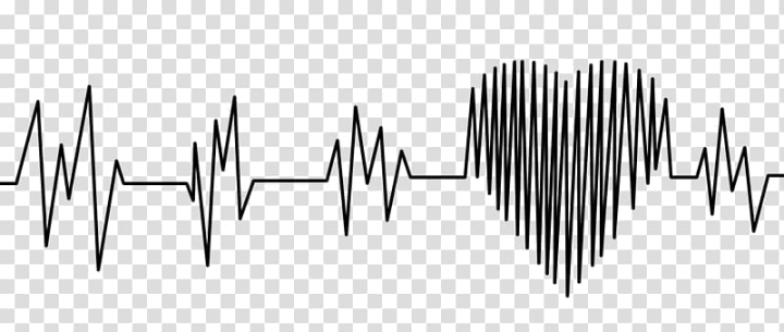 heart,rate,monitor,angle,text,monochrome,cardiac muscle,eeg,monochrome photography,objects,palpitations,string galvanometer,line,khan academy,heart rate,heart arrhythmia,hart,electrocardiogram,collapse,black and white,willem einthoven,electrocardiography,heart rate monitor,pulse,png clipart,free png,transparent background,free clipart,clip art,free download,png,comhiclipart
