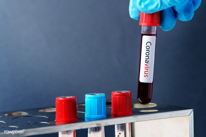 Free: Surgeon holding a blood test tube mockup | Free psd mockup ...