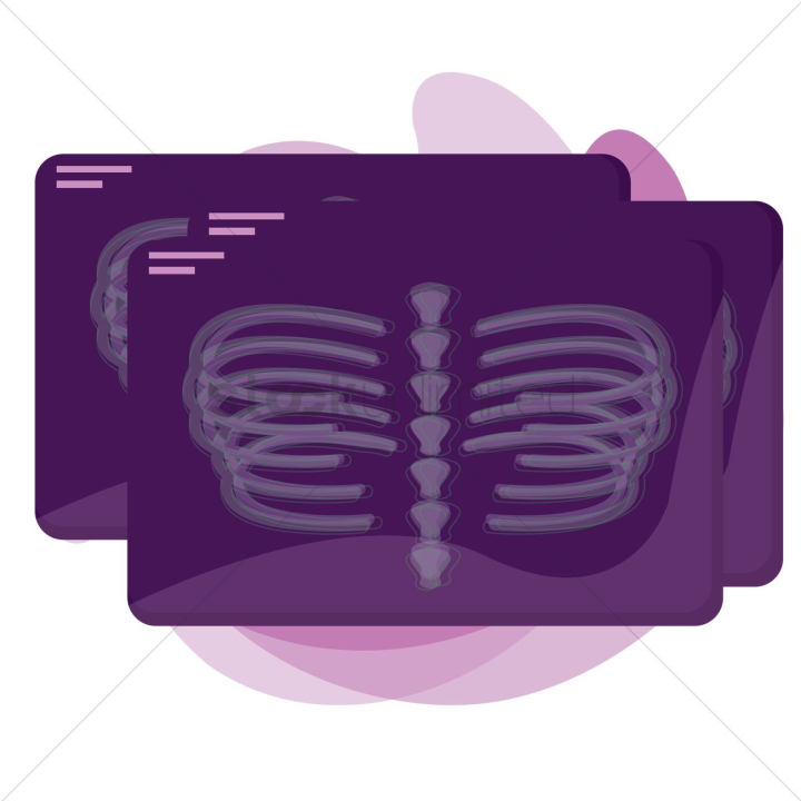 x ray,xray,ribs,rib,rib cage,orthopedics,bones,bone,radiation,radiations,chest,purple,healthcare,human,humans,people,person