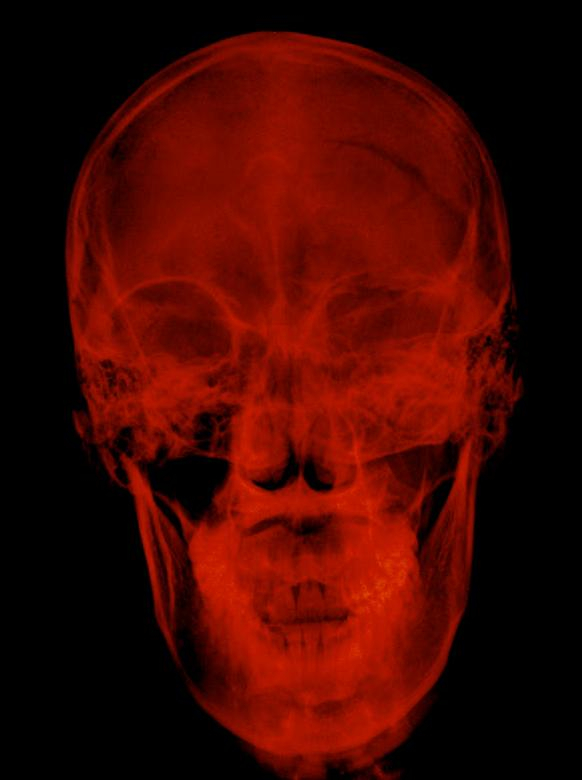 skull,xray,red,anatomy,asian,background,bone,brain,care,diagnosis,doctor,examination,face,film,head,health,hospital,human,image,imaging,incident,injury,isolated,lateral,man,medical,medicine,neck,neurological,neurology,orthopedic,patient,people,physical,radiation,radiograph,radiography,radiological,radiologist,radiology,ray,scan,science,skeleton,spine,technology,therapy,vertebrate,xrayimages,xrays,netstockvault