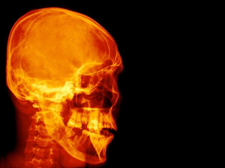 skull,xray,red,anatomy,asian,background,bone,brain,care,diagnosis,doctor,examination,face,film,head,health,hospital,human,image,imaging,incident,injury,isolated,lateral,man,medical,medicine,neck,neurological,neurology,orthopedic,patient,people,physical,radiation,radiograph,radiography,radiological,radiologist,radiology,ray,scan,science,skeleton,spine,technology,therapy,vertebrate,wallpaper,xrayimages,xrays,netstockvault